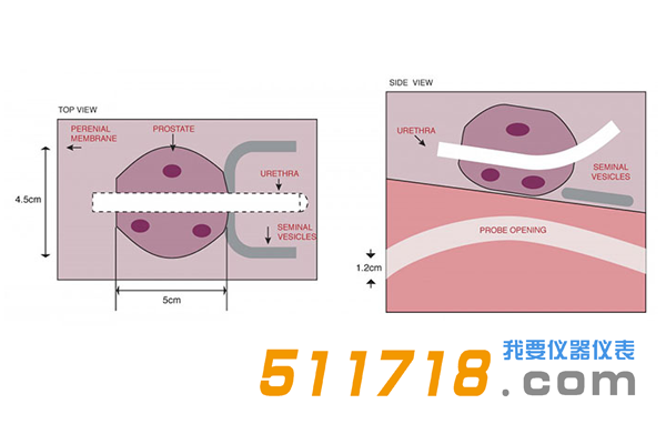 美國CIRS 053S 053L 053L-EF前列腺M(fèi)RI測試體模2.png